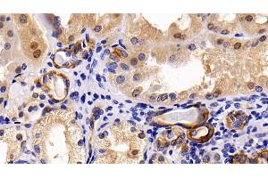 Detection of CK17 in Human Kidney Tissue using Polyclonal Antibody to Cytokeratin 17 (CK17) (KRT17 antibody  (AA 252-393))