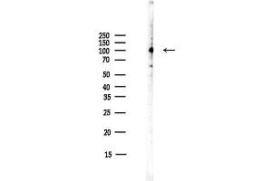 Western blot analysis of lysates from COLO205 cells(heat-shock,45 min treatment), using CDH17 Antibody at 1/1000 dilution.