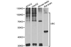 Western blot analysis of extracts of various cell lines, using UBC antibody. (UBC antibody  (AA 1-100))