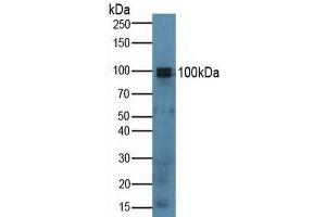 Detection of SPON1 in Mouse Lung Tissue using Polyclonal Antibody to Spondin 1 (SPON1) (SPON1 antibody  (AA 608-802))