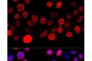 Immunofluorescence analysis of HeLa cells using BAZ1A Polyclonal Antibody at dilution of 1:100 (40x lens). (BAZ1A antibody)
