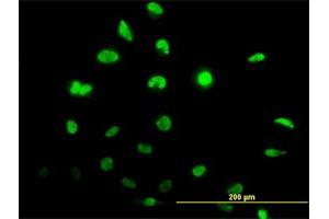 Immunofluorescence of monoclonal antibody to ID1 on HeLa cell.