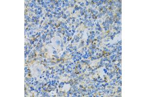 Immunohistochemistry of paraffin-embedded rat spleen using RPL13 antibody (ABIN1682571, ABIN5664631, ABIN5664633 and ABIN6220492) at dilution of 1:100 (40x lens). (RPL13 antibody  (AA 1-211))