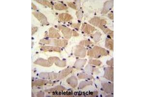 SUSD5 Antibody (C-term) immunohistochemistry analysis in formalin fixed and paraffin embedded human skeletal muscle followed by peroxidase conjugation of the secondary antibody and DAB staining. (SUSD5 antibody  (C-Term))
