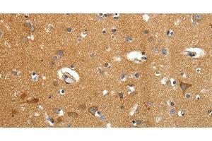 Immunohistochemistry of paraffin-embedded Human brain tissue using AMD1 Polyclonal Antibody at dilution 1:40 (AMD1 antibody)