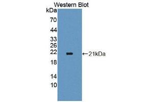 Figure. (PECI/ECI2 antibody  (AA 233-391))