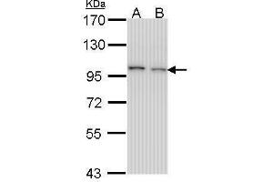 WB Image Sample (30 ug of whole cell lysate) A: H1299 B: Hela 7. (EPS8 antibody  (C-Term))