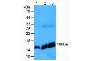 Figure. (Hemoglobin Subunit beta antibody  (AA 1-147))