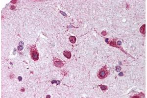 Human Brain, Cortex (formalin-fixed, paraffin-embedded) stained with PHB2 antibody ABIN239837 at 1:50 followed by biotinylated goat anti-rabbit IgG secondary antibody ABIN481713, alkaline phosphatase-streptavidin and chromogen. (Prohibitin 2 antibody  (C-Term))