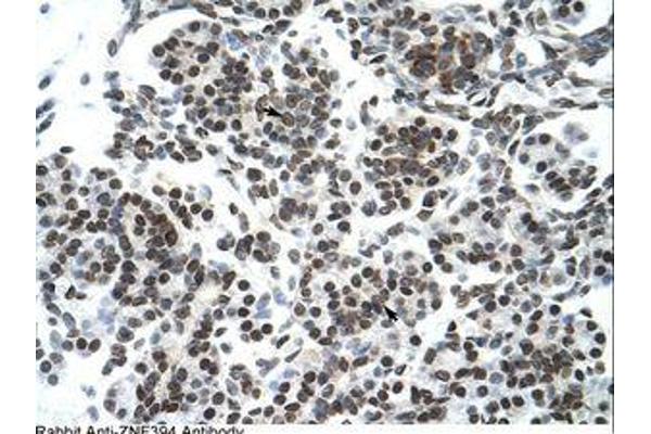 ZNF394 antibody  (N-Term)