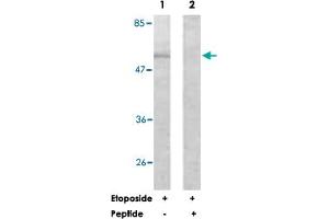 Western blot analysis of extracts from HeLa cells, treated with Etoposide (25 uM, 24 hours), using AKT1 polyclonal antibody . (AKT1 antibody)