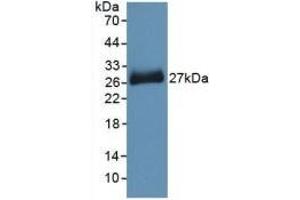 Detection of Recombinant PNOC, Mouse using Polyclonal Antibody to Pronociceptin (PNOC) (Pronociceptin (AA 12-187) antibody)