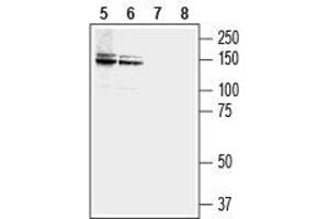 Western blot analysis of human LNCaP  prostate carcinoma (lanes 5 and 7) and MCF-7 breast adenocarcinoma (lanes 6 and 8) cell lysates: - 5,6. (NCAM2 antibody  (Extracellular))