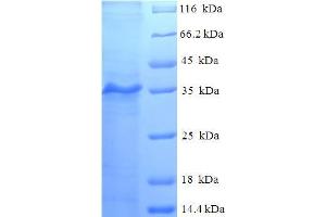 SDS-PAGE (SDS) image for Cerebral Palsy, Ataxic 1 (CPAT1) (AA 1-77), (full length) protein (GST tag) (ABIN5710001) (CPAT1 Protein (AA 1-77, full length) (GST tag))