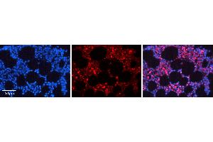 Immunohistochemistry (IHC) image for anti-Nuclear Factor of kappa Light Polypeptide Gene Enhancer in B-Cells 1 (NFKB1) (N-Term) antibody (ABIN2780565)