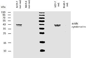 Western blotting analysis of human acidic cytokeratins using mouse monoclonal antibody AE1 on lysates of MCF-7 cell line and Molt-4 cell line (cytokeratin non-expressing cell line, negative control) under non-reducing and reducing conditions. (Keratin Acidic (AE1) antibody)