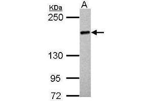 UGCGL2 antibody