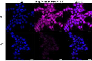 Immunocytochemical staining of HeLa cells using Ubiquitination factor E4 B antibody (ABIN7800713), 1:1,000), Top panel: wild-type (WT), Bottom panal: Ubiquitination factor E4 B shRNA knockdown (KD). (Recombinant UBE4B antibody)