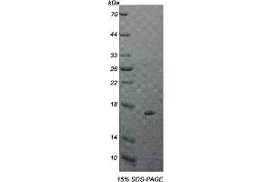 15% SDS-PAGE analysis of recombinant IL5Ra Protein. (IL5RA Protein)