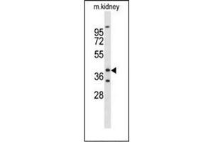 Western blot analysis ofFOXL1 / FKHL11 Antibody (Center) in mouse kidney tissue lysates (35ug/lane). (FOXL1 antibody  (Middle Region))