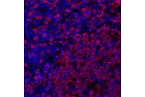 Immunofluorescence (IF) image for anti-HLA-DR (HLA-DR) antibody (ABIN7449537) (HLA-DR antibody)