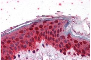 Human Skin: Formalin-Fixed, Paraffin-Embedded (FFPE) (HOXB7 antibody  (AA 55-121))