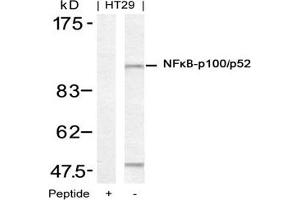 Image no. 3 for anti-Nuclear Factor of kappa Light Polypeptide Gene Enhancer in B-Cells 2 (NFKB2) (Ser871) antibody (ABIN197572) (NFKB2 antibody  (Ser871))