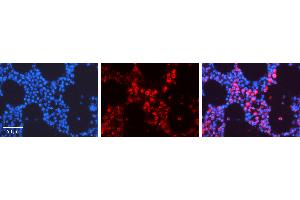 Rabbit Anti-TUBB2A Antibody Catalog Number: ARP40177_P050 Formalin Fixed Paraffin Embedded Tissue: Human Bone Marrow Tissue Observed Staining: Cytoplasm Primary Antibody Concentration: 1:100 Other Working Concentrations: 1:600 Secondary Antibody: Donkey anti-Rabbit-Cy3 Secondary Antibody Concentration: 1:200 Magnification: 20X Exposure Time: 0. (TUBB2A antibody  (Middle Region))