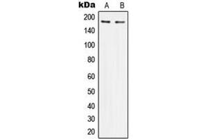 Western blot analysis of IRS1 expression in HeLa (A), HEK293 (B) whole cell lysates. (IRS1 antibody  (Center))