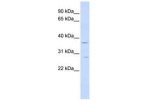 Image no. 1 for anti-Interferon gamma Receptor 2 (Interferon gamma Transducer 1) (IFNGR2) (AA 180-229) antibody (ABIN6740980) (IFNGR2 antibody  (AA 180-229))