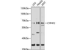 Western blot analysis of extracts of various cell lines, using CYP4F2 antibody (ABIN6130171, ABIN6139366, ABIN6139367 and ABIN6214266) at 1:1000 dilution. (CYP4F2 antibody  (AA 40-120))