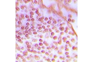 Immunohistochemical analysis of DNA-PKcs staining in human tonsil formalin fixed paraffin embedded tissue section. (PRKDC antibody  (C-Term))