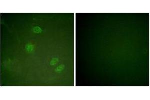 Immunofluorescence analysis of HeLa cells, using Elk3 (Ab-357) Antibody. (ELK3 antibody  (AA 323-372))