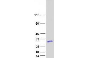 Western Blotting (WB) image for Ribosomal Protein S5 (RPS5) protein (Myc-DYKDDDDK Tag) (ABIN2731172)
