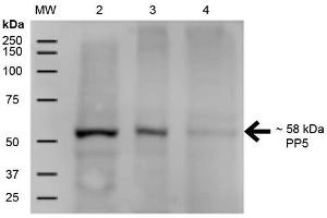 Western Blot analysis of Human A431, HEK293, and Jurkat cell lysates showing detection of ~58 kDa PP5 protein using Mouse Anti-PP5 Monoclonal Antibody, Clone 12F7 .