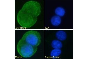 ABIN6391413 Immunofluorescence analysis of paraformaldehyde fixed MCF7 cells, permeabilized with 0. (PDGFB antibody  (C-Term))