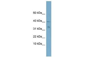NDUFV3 antibody used at 1 ug/ml to detect target protein. (NDUFV3 antibody)