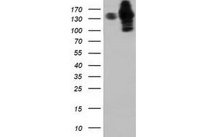 HEK293T cells were transfected with the pCMV6-ENTRY control (Left lane) or pCMV6-ENTRY HDAC6 (Right lane) cDNA for 48 hrs and lysed. (HDAC6 antibody)