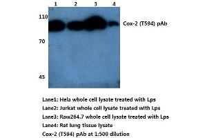 Western blot (WB) analysis of Cox2/PGHS2 (pThr594) antibody (PTGS2 antibody)