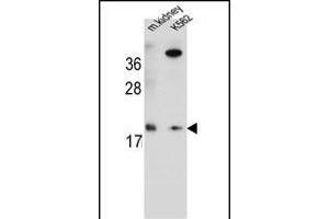 R Antibody (Center) (ABIN654772 and ABIN2844451) western blot analysis in mouse kidney tissue and K562 cell line lysates (35 μg/lane). (RNF185 antibody  (AA 88-117))
