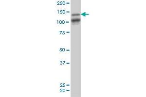 MAGI1 monoclonal antibody (M03), clone 7B4 Western Blot analysis of MAGI1 expression in PC-12 . (MAGI1 antibody  (AA 761-859))