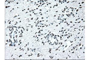 Immunohistochemistry (IHC) image for anti-Interferon Regulatory Factor 3 (IRF3) antibody (ABIN2723790)