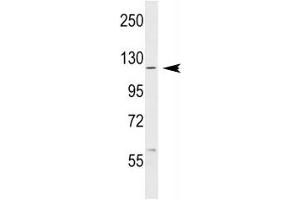 Western Blotting (WB) image for anti-C-Abl Oncogene 1, Non-Receptor tyrosine Kinase (ABL1) (AA 851-881) antibody (ABIN3030214)