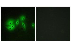 Immunofluorescence (IF) image for anti-Adenylate Cyclase 8 (Brain) (ADCY8) (Internal Region) antibody (ABIN1850180) (ADCY8 antibody  (Internal Region))