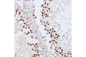 Immunohistochemistry of paraffin-embedded rat testis using KLF12 antibody (ABIN7268152) at dilution of 1:100 (40x lens). (KLF12 antibody)