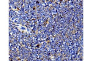 IHC analysis of Il13 using anti-Il13 antibody (ABIN7600672). (IL-13 antibody  (AA 22-131))