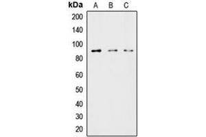 Western blot analysis of HSL expression in HeLa (A), MCF7 (B), COLO205 (C) whole cell lysates. (LIPE antibody  (Center))