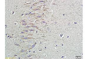 Formalin-fixed and paraffin embedded rat brain labeled with Anti-HRG BETA1, Unconjugated (ABIN734873) followed by conjugation to the secondary antibody and DAB staining (Neuregulin 1 antibody  (AA 221-320))