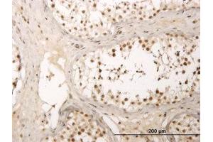 Image no. 1 for anti-Zinc Finger Protein 213 (ZNF213) (AA 133-243) antibody (ABIN599017) (ZNF213 antibody  (AA 133-243))