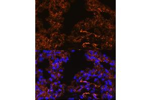 Immunofluorescence analysis of Rat lung cells using Caveolin-1 antibody (ABIN6131271, ABIN6137992, ABIN6137993 and ABIN6218615) at dilution of 1:100. (Caveolin-1 antibody  (AA 1-100))